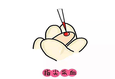 儿童91麻豆成人精品国产免费网站微量元素的检测项目有哪些 儿童91麻豆成人精品国产免费网站微量元素的检测项目有哪些