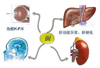 人体在线观看麻豆视频数据能够准检测出但身体中微量元素铜超标会引起疾病发生 人体在线观看麻豆视频数据能够准检测出但身体中微量元素铜超标会引起疾病发生